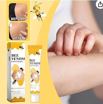 Fivfivgo Vitigo Bee Venom Correcting Cream 20g | Skin Tone Balancing And Pigmentation Repair Cream